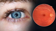 Artikelbild för artikeln: Ny genterapi gav blinda patienter delar av synen tillbaka
