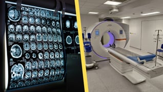 Artikelbild för artikeln Skickades hem från akuten - dog av blödning i hjärnan