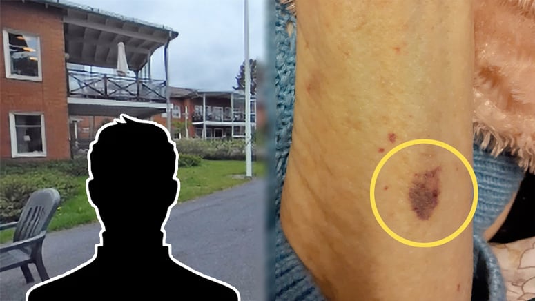 Artikelbild för artikeln: Personal misshandlade 96-årig kvinna på äldreboende – åtalas