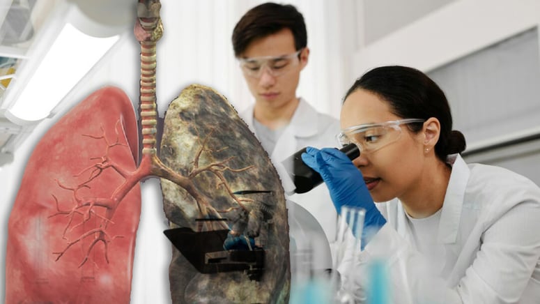 Artikelbild för artikeln: Forskare: Mer än var tredje cancerfall kan förebyggas