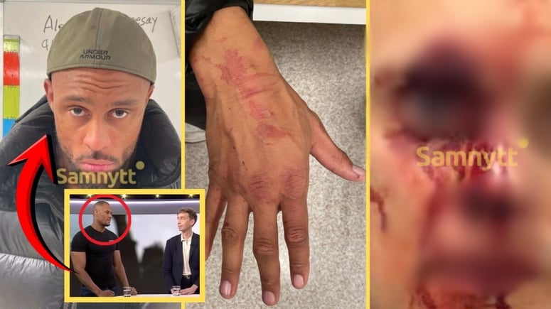 Artikelbild för artikeln: SVT-rapparen Alex Ceesay "lämnade kriminaliteten" och hittade Allah - åtalas nu för "vansinnesattack"