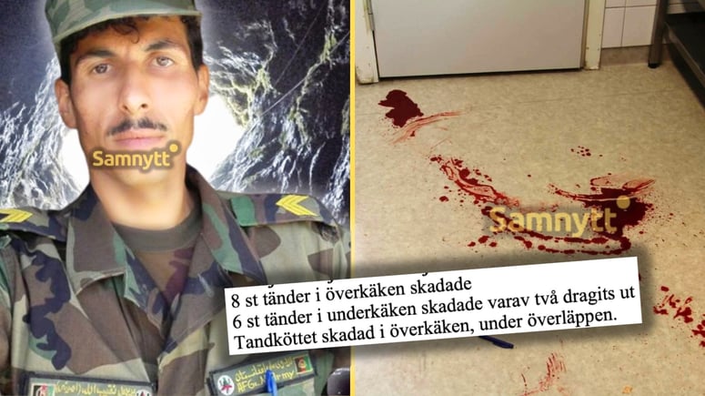 Artikelbild för artikeln: BILDEXTRA: Afghan som våldtog och kastade ned kvinna i gruvhål fick tänderna utslagna i fängelset
